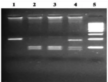 Figure 1. Electrophoregram (3% agarose gel) of Ava II digested PCR product generated by amplification of  genomic DNA using Citrullinaemia specific primers.Line # 1:PCR product of 185bp, line # 2&amp; 