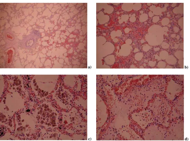 Fig. 1 – The most common pulmonary histopathological findings in forensic autopsies of illicit drug users a) pulmonary edema with erythrocytes and neutrophils in alveoli (H&amp;E staining, 40);