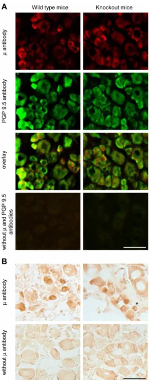 Figure 2. Non-specific staining of m-opioid receptors in DRG neurons. (A) Representative double immunofluorescence images showing similar m-receptor and PGP 9.5 staining in DRG neurons of wild type mice (left panel) and m/d/k-opioid receptor knockout mice 