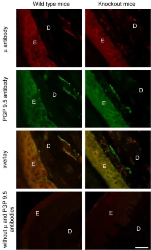 Fig. 6B). Likewise, there were no significant alterations in the labeling intensity of m-receptors in sensory fibers after surgeries (p 