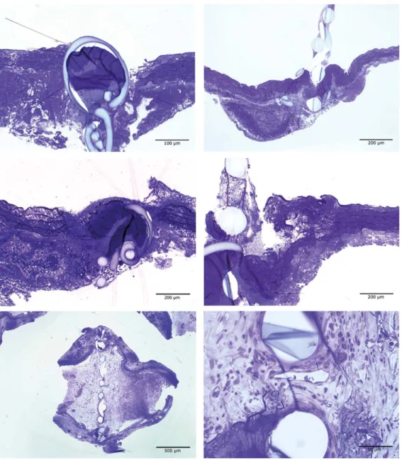 Figure 4. Typical histological changes of the occluded anastomoses: Upper row 4 hours postoperatively showing culpable, traumatic (t) proximal anastomosis ( left, 130x magnification ) with occluded filter anstomosis ( right, 65x magnification ); middle row