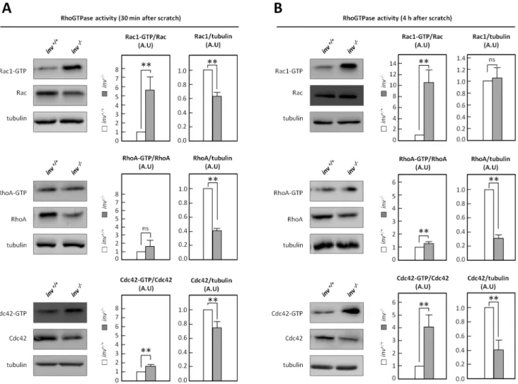 Figure 4. Inversin affects the activity of the Rho GTPases. Activity of Rac-1, RhoA and Cdc42 was determined by pull-down in migrating inv +/+