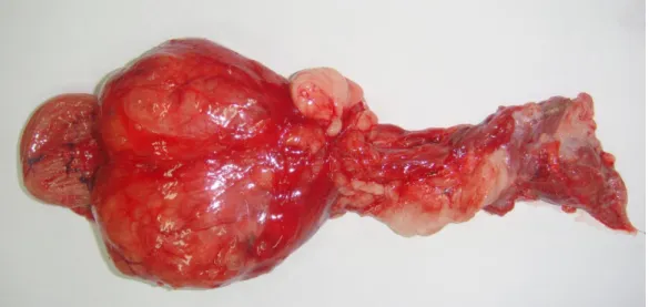 Figure 1. Prostate at macroscopy with enlarged lobes. 