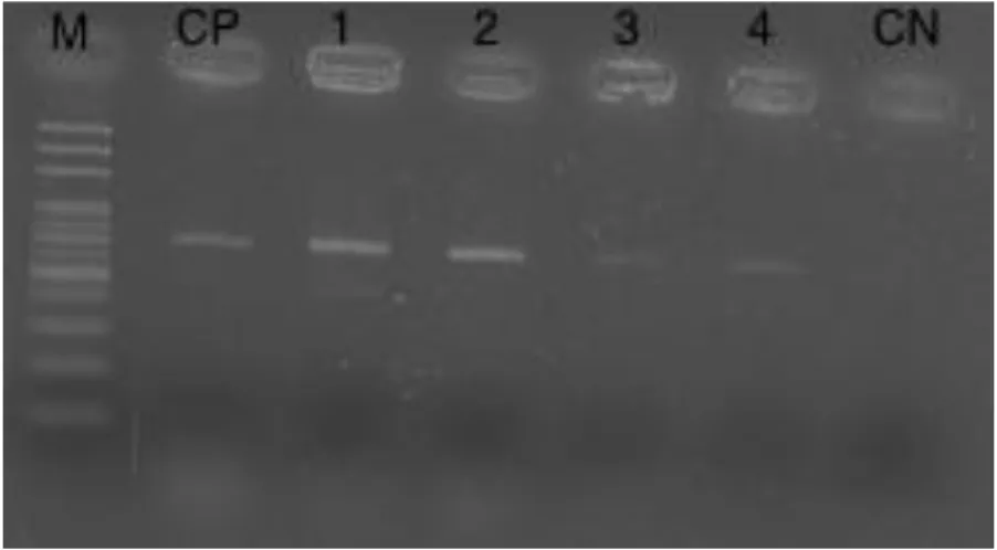Figura 1 -  Produtos de amplificação de 702pb, específicos de L. monocytogenes, obtidos pelo  método de extração de DNA por lise térmica ( M: marcador de peso molecular; CP: controle  positivo, 1,2,3,4: amostras, CN: controle negativo) 