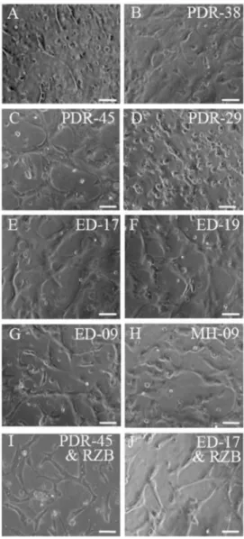 Figure 2. Representative phase images of tube formation induced by vitreous from PDR/ED/MH patients in human dermal microvascular endothelial cell (HMEC)