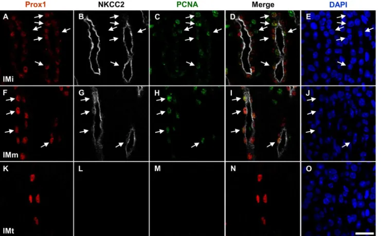 Fig 7. Co-localization of Prox1 and PCNA in the NKCC2-positive TAL of the developing mouse kidney