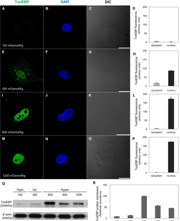 Fig 9. Expression and distribution of TonEBP in response to changes in osmolality in vitro 