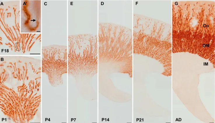 Fig 3. NKCC2 expression during mouse kidney development. Immunostaining of NKCC2 in the kidneys from 18-day-old fetuses (A) and from 1- (B), 4- 4-(C), 7- (D), 14- (E) and 21-day-old pups (F) and adults (G)