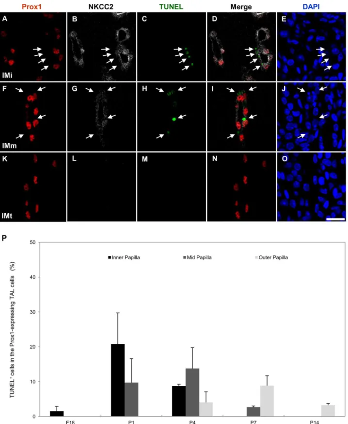 Fig 6. Cells undergoing apoptosis in the Prox1- and NKCC2-positive TAL of the developing mouse kidney