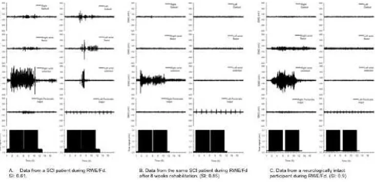 Figure 5. An example raw data from a SCI patient during wrist extension/flexion with palm down and similar data from a neurologically intact participant
