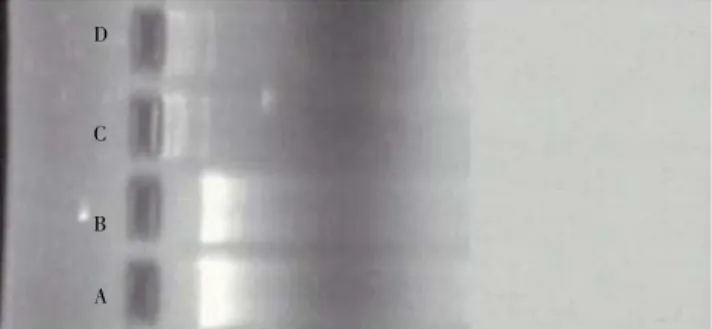 Figure 4.  I llustration of sheared and normal  DNA  isolated from P. aeruginosa  and E