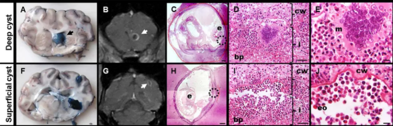 Fig 5. Correlation between EB staining, MRI findings and histology in deep and superficial cysts from PZQ+ABZ 5d group