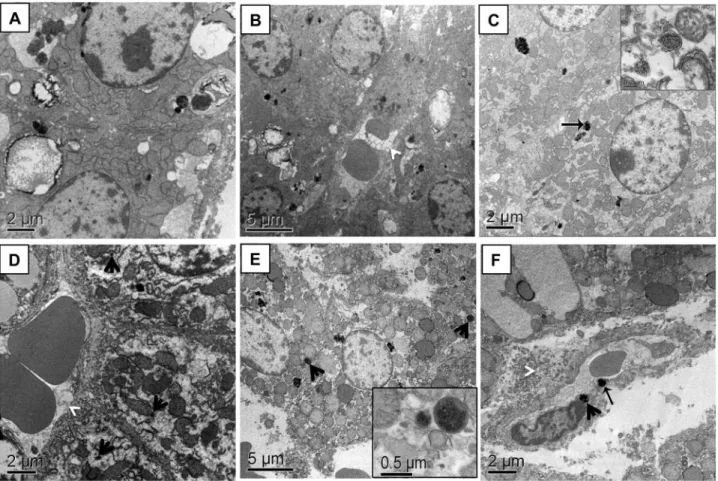Fig 2. Electron micrograph of capuchin monkey liver tissue. (A and B) Control animal samples with intact hepatocytes