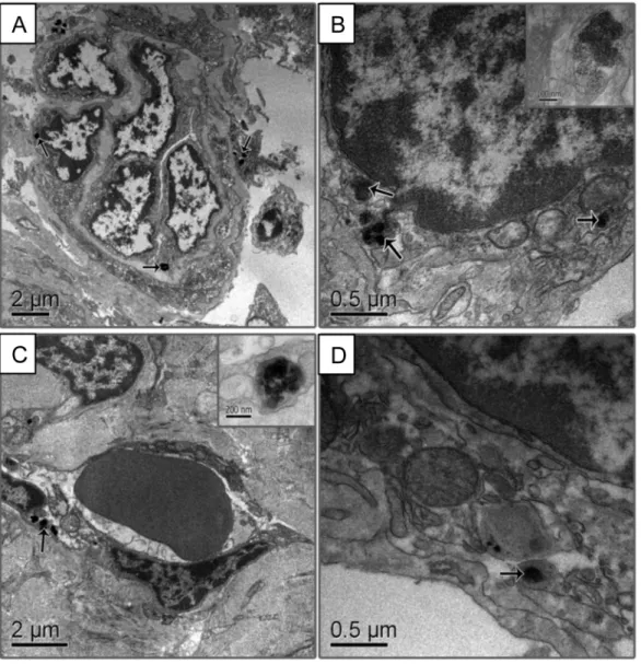 Fig 4. Electron micrographs of capuchin monkey spleen tissue. (A) Control animal showing normal ultrastructure morphology of the spleen and endogenous pigment (arrow)