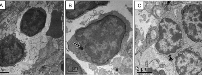 Fig 5. Electron micrograph of capuchin monkey lymph node tissue. (A) Control animal. Lymphocyte showing normal ultrastructure