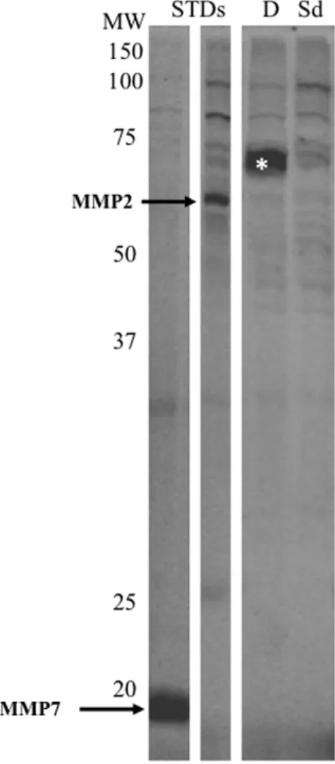 Figure 5. Enzymatic immunoassay for LTB4. Secreted proteomes of DMSO-treated and sulindac sulfide-treated cells were analyzed for LTB4 levels using an enzymatic immunoassay.