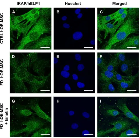 Figure 3. IKAP/hELP1 distribution in hOE-MSCs. Anti-IKAP/hELP1 immunofluorescence staining in control (A, B, C), FD hOE-MSCs (D, E, F), and FD hOE-MSCs treated with 100 mM kinetin for 24h (G, H, I)