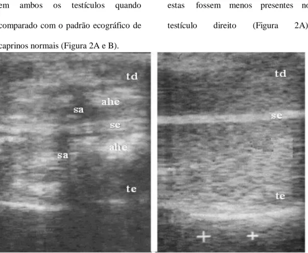 Figura  2:  Ultrassonografia  de  testículo  caprino  com  degeneração  testicular  (A)  apresentando áreas hiperecóicas (ahe) e sombra acústica (sa), tanto no testículo direito  (td) como esquerdo (te), que se encontram separados pelo septo escrotal (se)