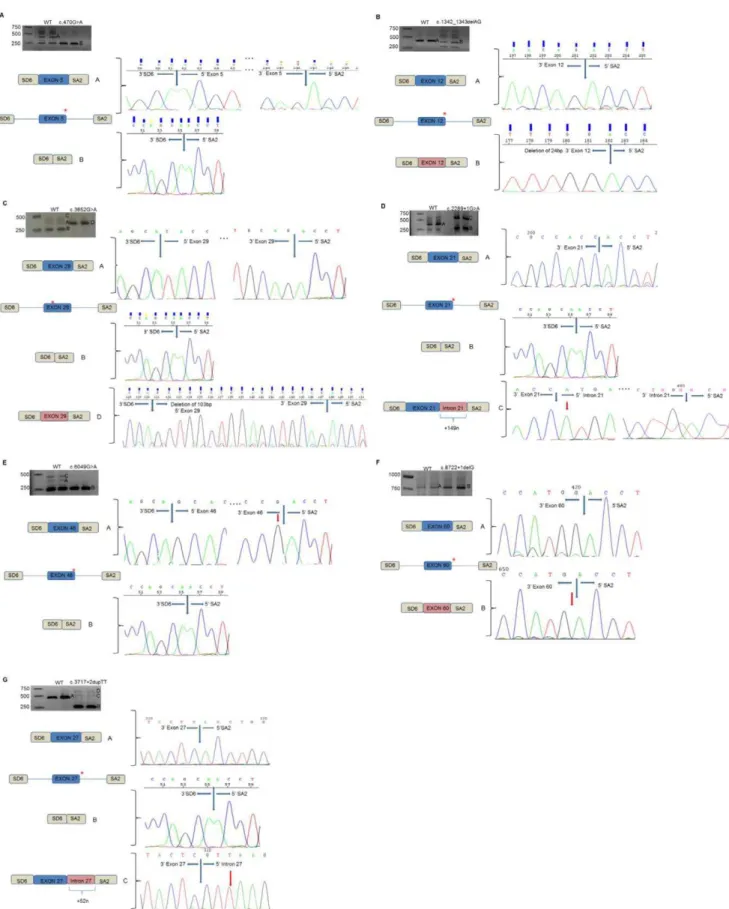 Figure 1. In vitro splicing assays for the seven splicing mutations identified in the USH1 genes