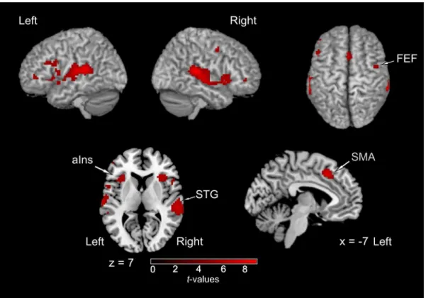 Figure 5. Areas related to the localization of sounds in a ‘‘cocktail-party situation’’