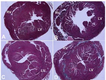 Figure 3. Gomori’s tri-chrome stained slides of cardiac tissue showing increased fibrosis in mdx mice