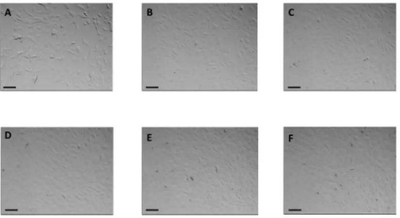 Fig 4. On-line microscopy of endothelial cells cultured in the ENDOXY system during the first 36 hours