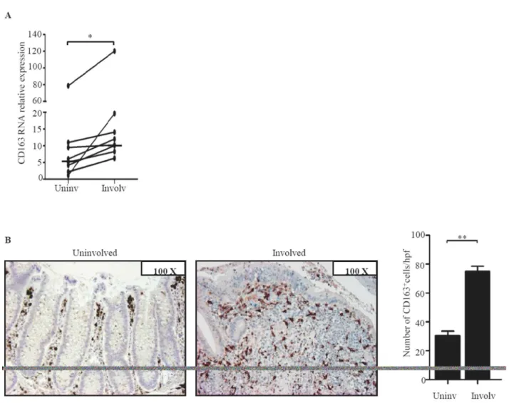 Figure 2. CD163 protein expression is increased in IBD. A. Representative Western blots showing CD163 and b actin in total proteins extracted from mucosal samples of 2 CTR, 2 UC patients and 2 CD patients