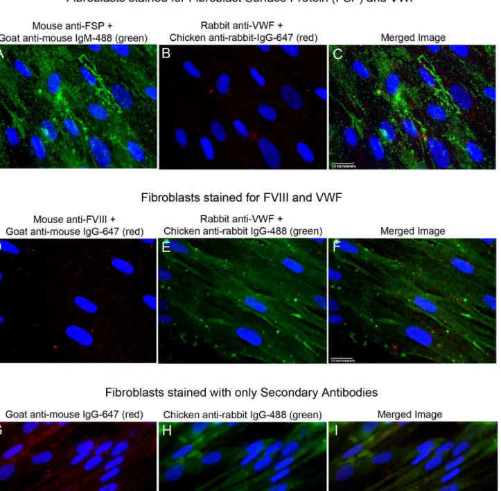 Fig 4. Fluorescent images of stained fibroblasts. Fibroblasts were stained with antibodies to Fibroblast Surface Protein (FSP), FVIII, and VWF plus relevant secondary antibodies, or with secondary detection antibodies alone