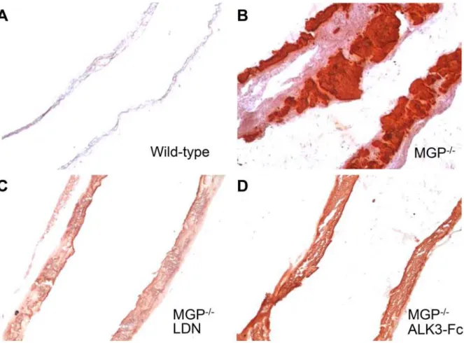 Figure 2. Vascular calcification associated with MGP deficiency is dependent on bone morphogenetic protein signaling