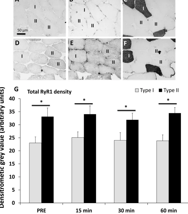 Illustration of DAB stained consecutive myofiber cross-sections showing (D) total RyR1, (E) pRyR1Ser 2843 and (F) corresponding MyHC1 staining displaying type I myofibers (black) and type II myofibers (unstained)