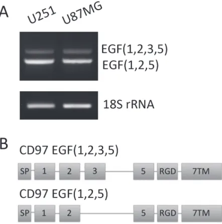 Figure 1. Characterization of CD97 isoforms in glioblastoma. RNA was isolated from the GBM cell lines U251 and U87MG, then converted to cDNA