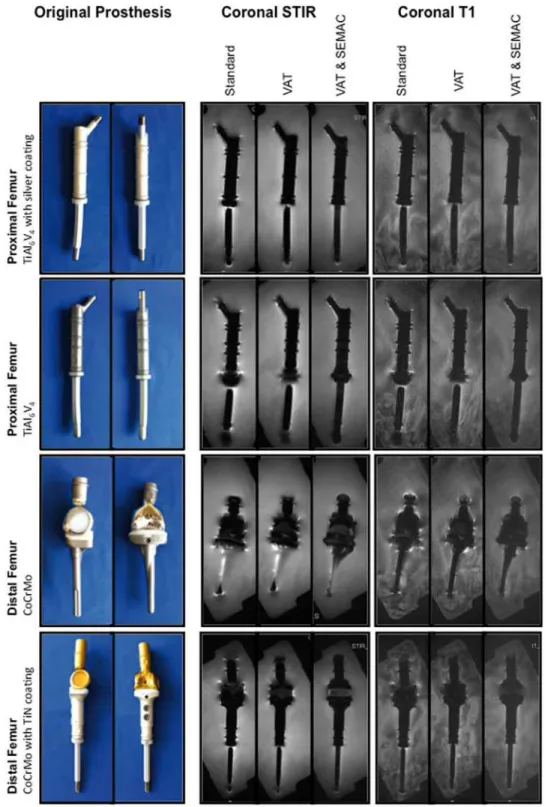 Fig 1. Experimental model. Tumor endoprostheses were embedded in water. Specifications and materials are indicated on the left