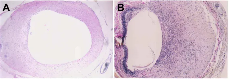 Figure 1. Neointimal thickening in grafted veins. Photomicrographs showing representative cross sections of an H&amp;E-stained grafted vein on day 7 (A) and Verhoffe-Van Gieson-stained grafted vein on day 14 (B)