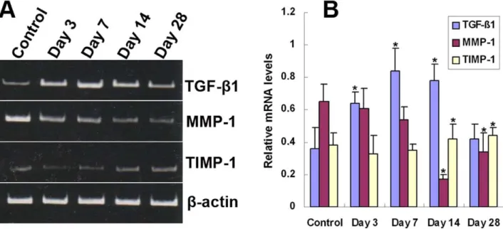 Figure 4. Temporal expression of TGF-b1, MMP-1, and TIMP-1 protein in grafted veins. Western blot was performed to determine the expression of TGF-b1, MMP-1 and TIMP-1 in grafted veins on days 3, 7, 14, and 28