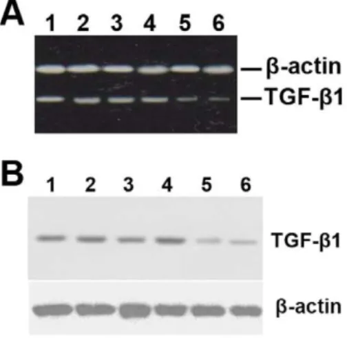 Table 3. Immunohistochemical staining for MMP1 and TIMP1 in grafted veins after nanoparticle-mediated delivery of the TGF-b1 antisense-expressing construct (n = 15)