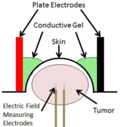 Figure 1. Schematic of experimental setup. Plate electrodes are placed on either side of the subcutaneous murine tumor, with a highly conductive gel facilitating improved current delivery into the tumor.