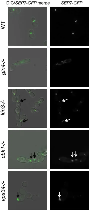 Figure 4. Septins are mislocalized in some PK mutant strains.