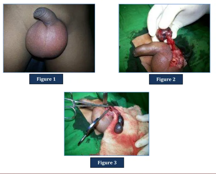 Figure 1  Figure 2 