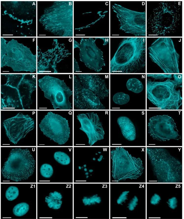 Figure 4. Fluorescence imaging of mCerulean3 fusion vectors. Images were recorded in widefield or laser scanning confocal fluorescence microscopy