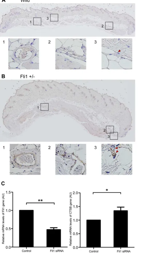 Figure 5. CTSB expression was up-regulated in dermal vasculature of Fli1 +/2 mice and in Fli1 siRNA-treated HDMECs.