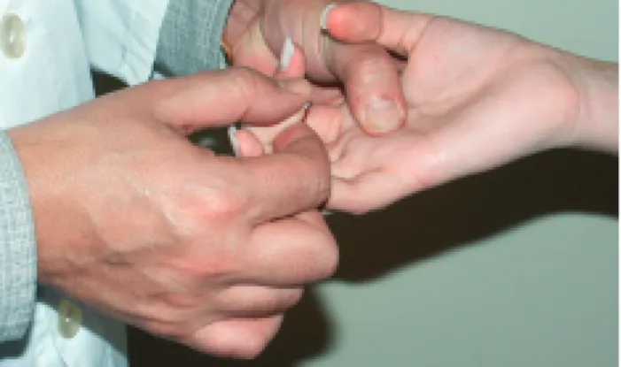 Figura 8 - Palpação dos tendões dos flexores dos dedos: dedo em gatilho.