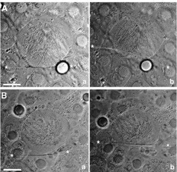 Figure 4. Cortical Stiffness Correlates with Local Density of Cortical Actin (A) After the spindle was repositioned and collapsed to induce cortical flow, we tested the stiffness of the actin-dense region of the cortex