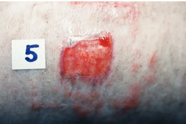 Figure 5.  Gross appearance of t he sit e aft er 21 day s of t he t reat m ent  wit h chit in FD