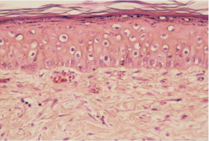 Figure 9.  Dorsal skin aft er 14 day s of t he t reat m ent  w it h CT chit osan. 