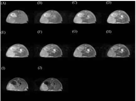 Fig 4. Dynamic contrast enhanced T1-weighted images before (A), 0.5 (B), 5 (C), 10 (D), 15 (E), 20 (F), 25 (G), and 30 (H) min after intravenous administration of SPIO