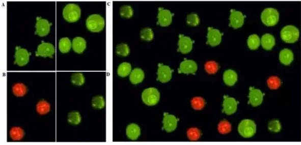 Figure 7 AO/PI double-staining. Early apoptotic features such as chromatin condensation and blebbing were witnessed after 24 and 48 h of PCC (6.25 µ g/ml) treatment