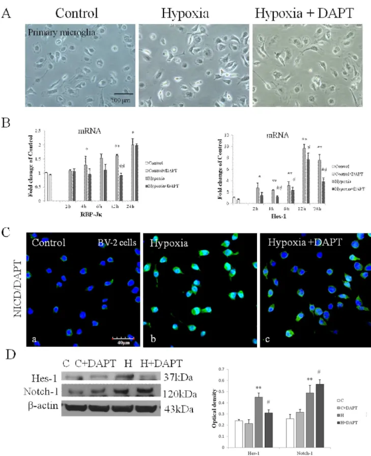 Figure 4. Notch signaling blockade in primary microglia and BV-2 cells by DAPT. (A) No obvious morphological difference was observed in Hypoxia and Hypoxia+DAPT groups compared with the control primary microglia under the phase-contrast microscope