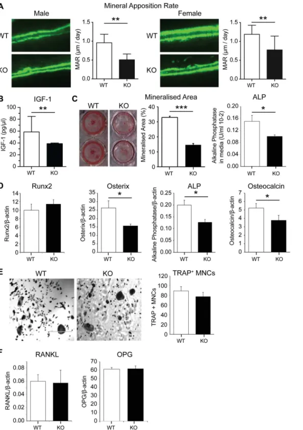 Fig 4. Bone cell activity and expression analysis of PWCR KO mice. A.) Bone histomorphometric analysis of double fluorochrome labelled femur sections showing Mineral Apposition Rate (MAR)