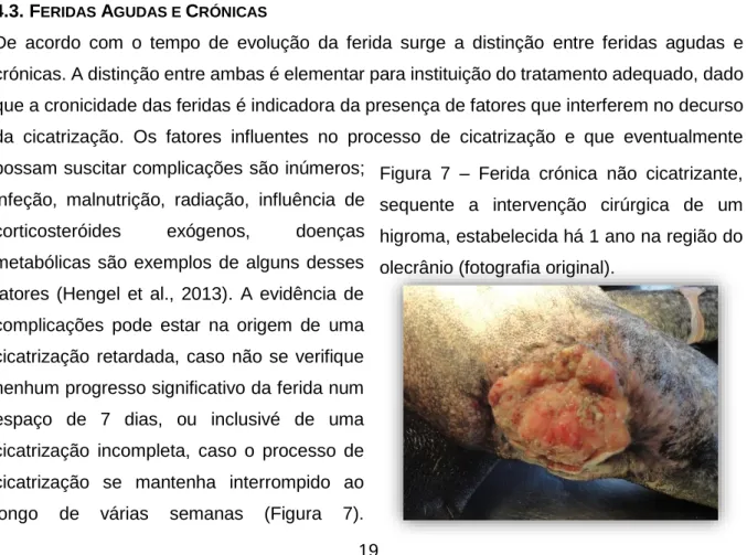 Figura  7  –  Ferida  crónica  não  cicatrizante,  sequente  a  intervenção  cirúrgica  de  um  higroma, estabelecida há 1 ano na região do  olecrânio (fotografia original)
