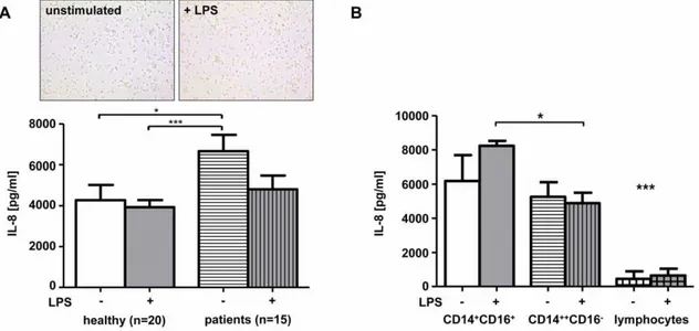 Figure 5. IL-8 secretion by monocyte-derived macrophages. (A) Macrophages were derived from blood monocytes of healthy donors (n = 20) and patients with Child B or C liver cirrhosis (n = 15)